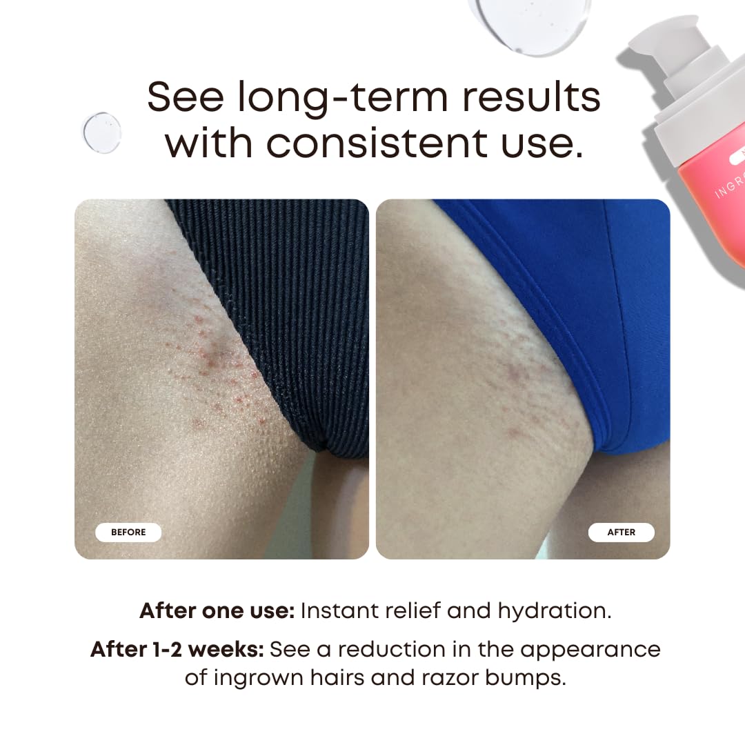 Bushbalm Ingrown Hair 2-Step Routine, Watermelon Sugar