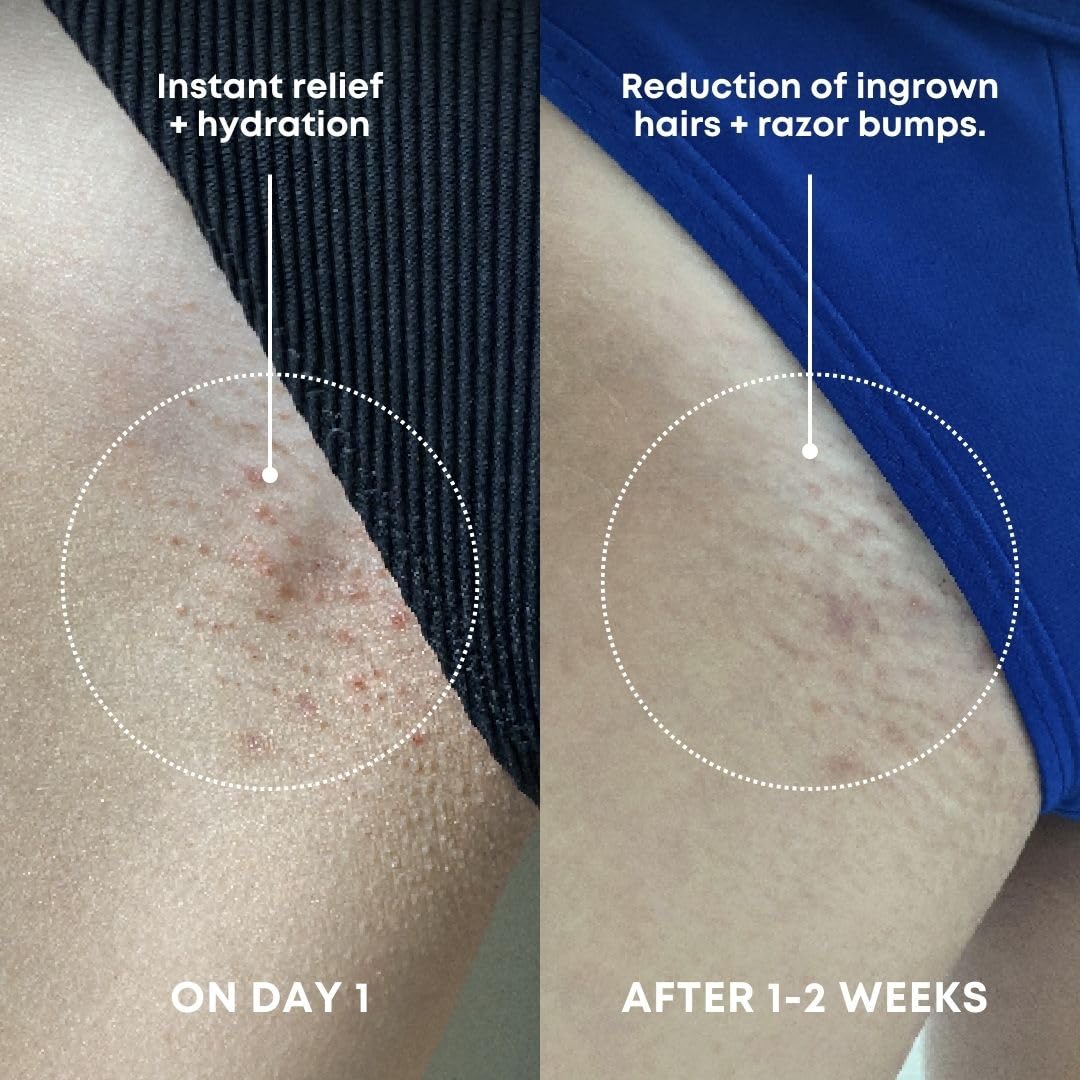 Bushbalm Ingrown Hair Exfoliating Scrub, Nude, 236 ml