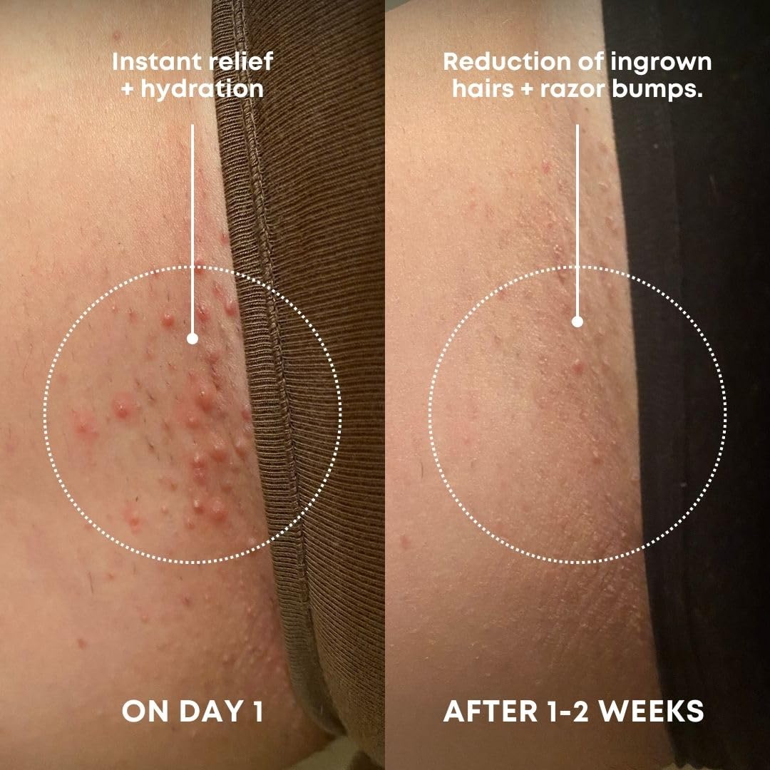 Bushbalm Ingrown Hair Exfoliating Scrub, Nude, 236 ml