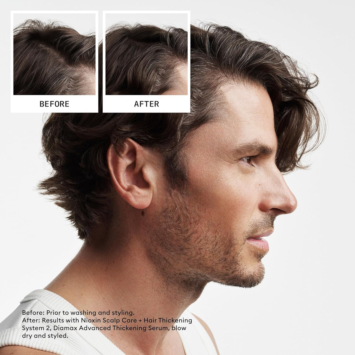 Nioxin Scalp + Hair Thickening System 2 Shampoo, 16.9 fl oz