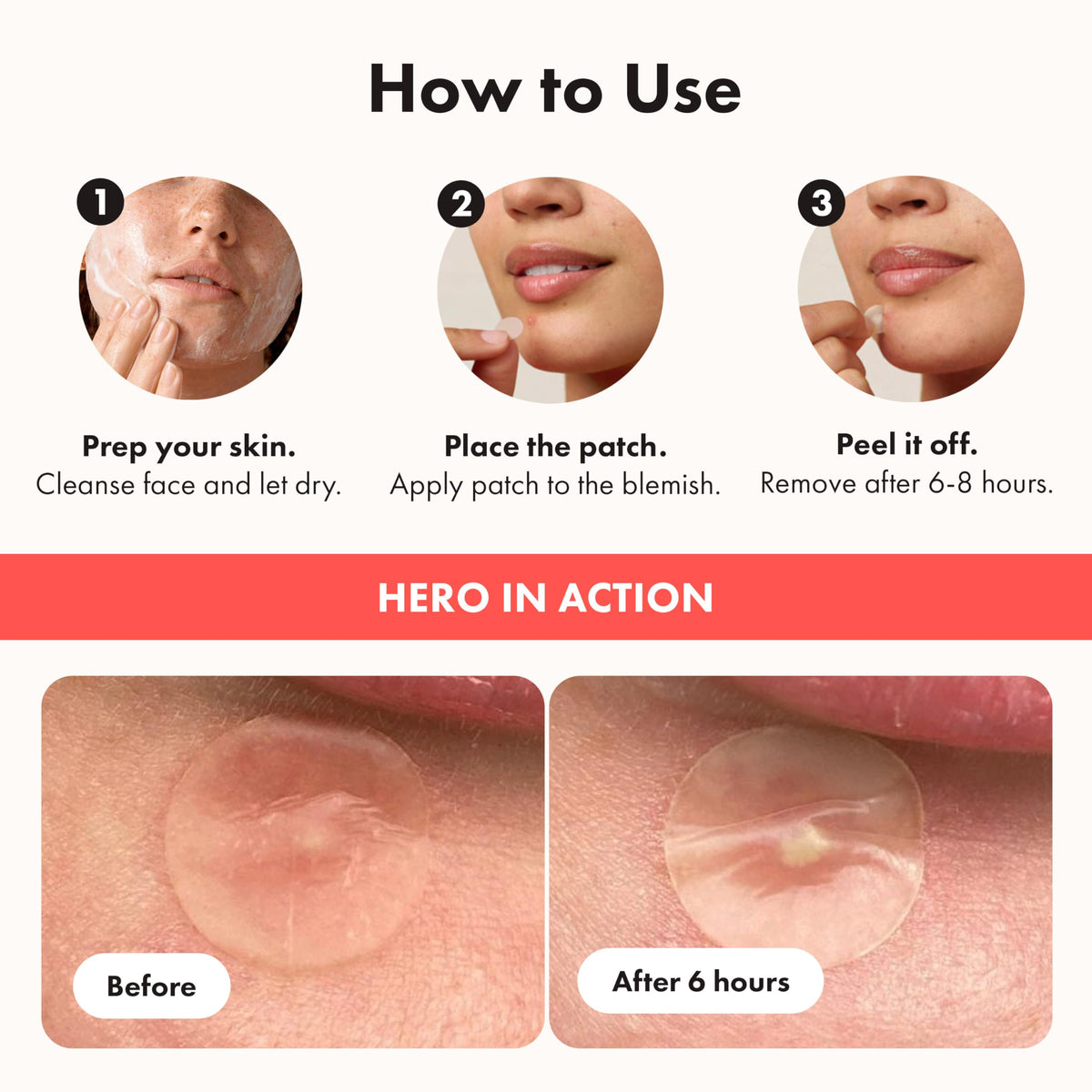 Hero Cosmetics Mighty Patch Original Hydrocolloid Patches, 36 Count