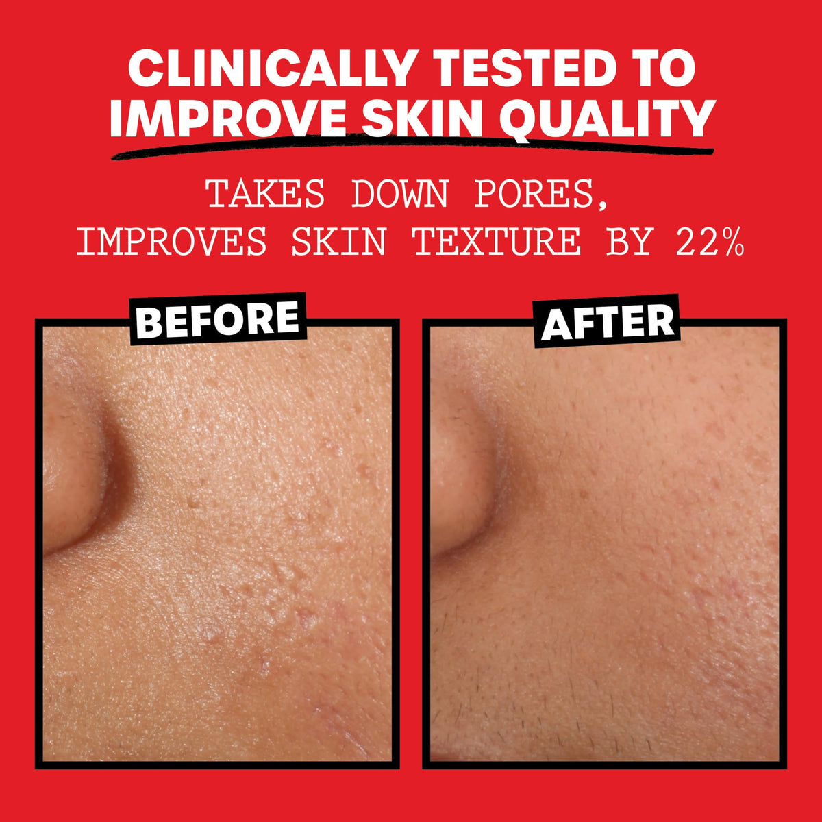 Thayers Alcohol-Free Rose Petal Witch Hazel Toner, 2 x 355 ml