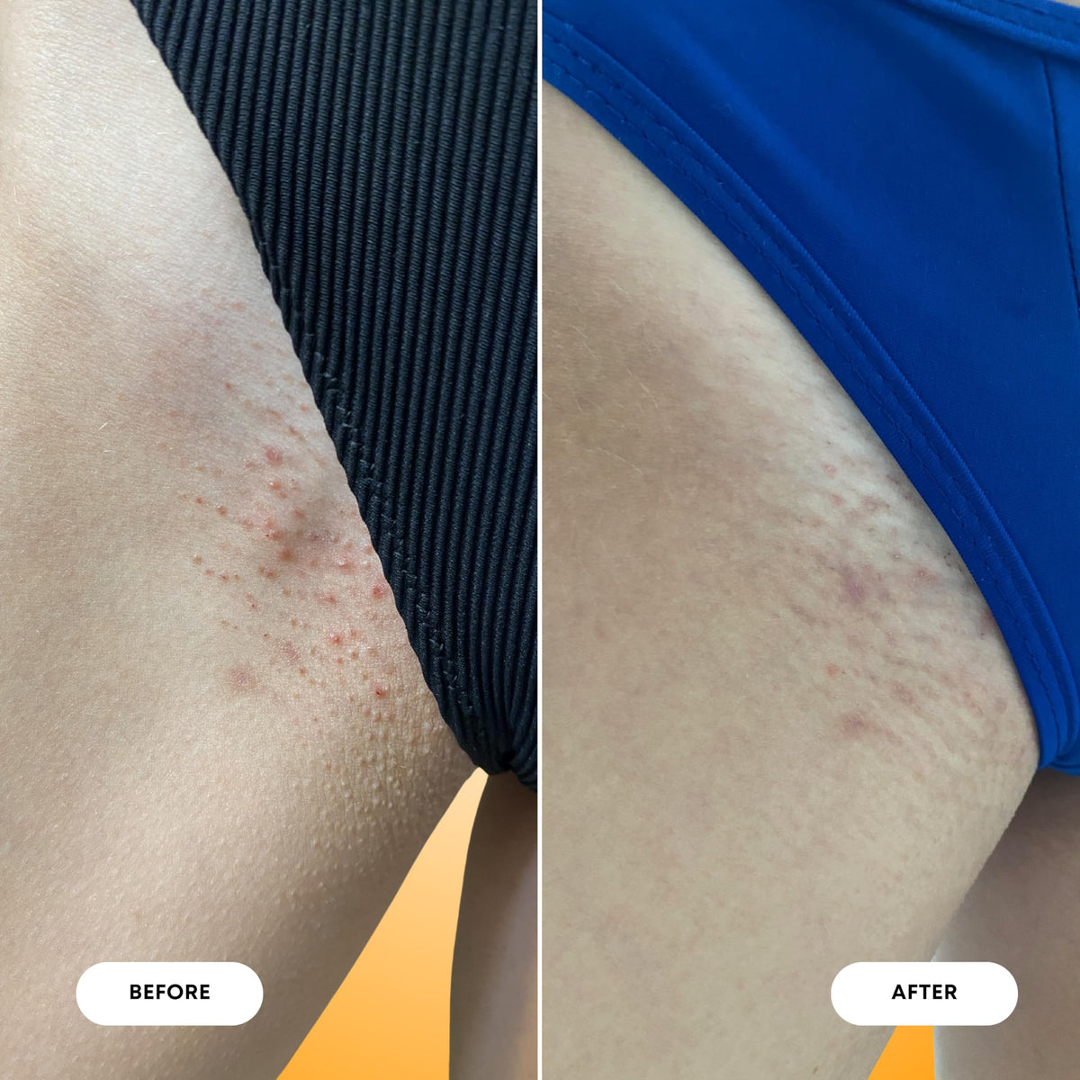 Bushbalm Ingrown Hair 2-Step Routine, Vanilla Tangerine
