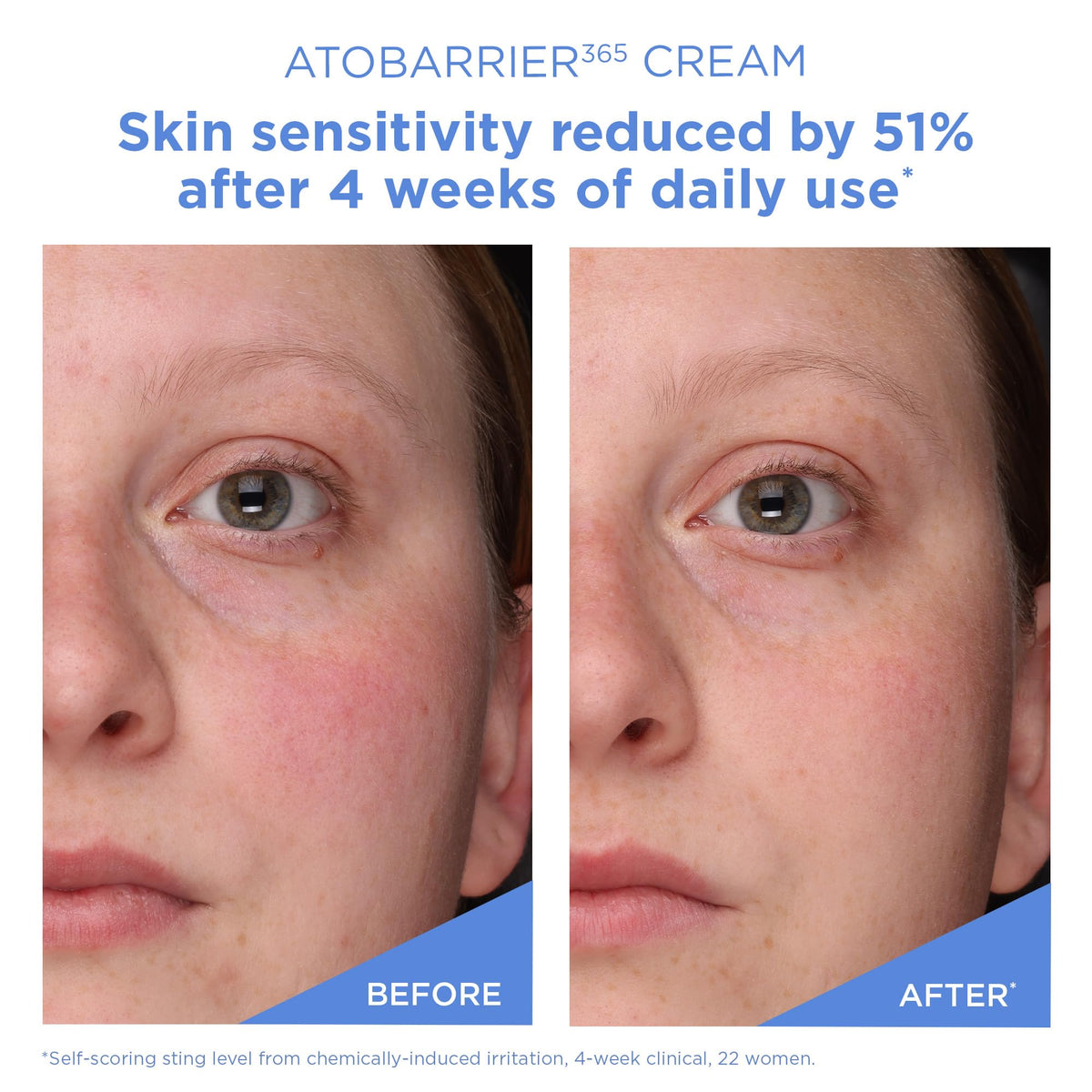 Aestura Atobarrier365 Cream with Ceramides, 80 mL (2.70 fl oz)