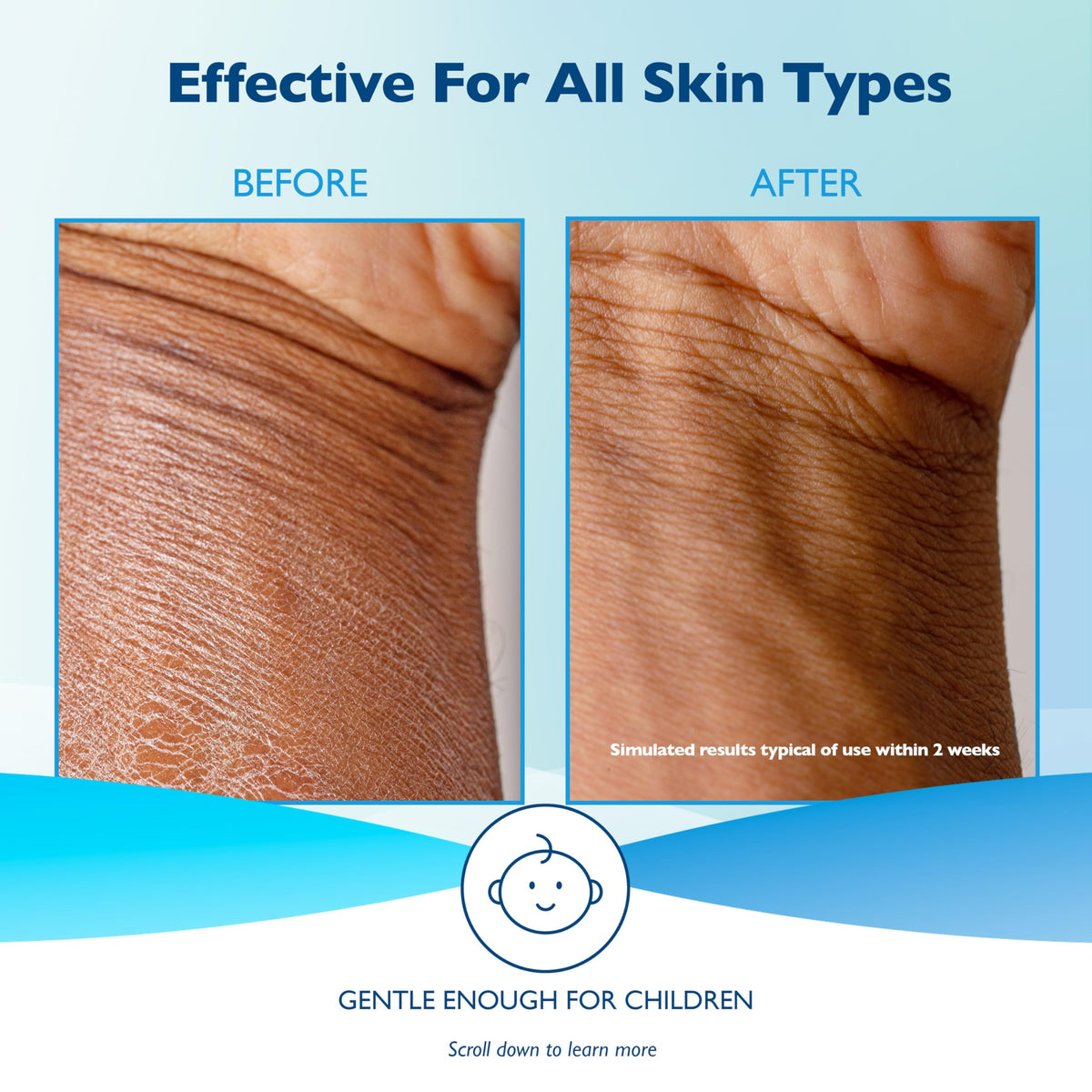 Glaxal Base Moisturizing Cream, 450 g