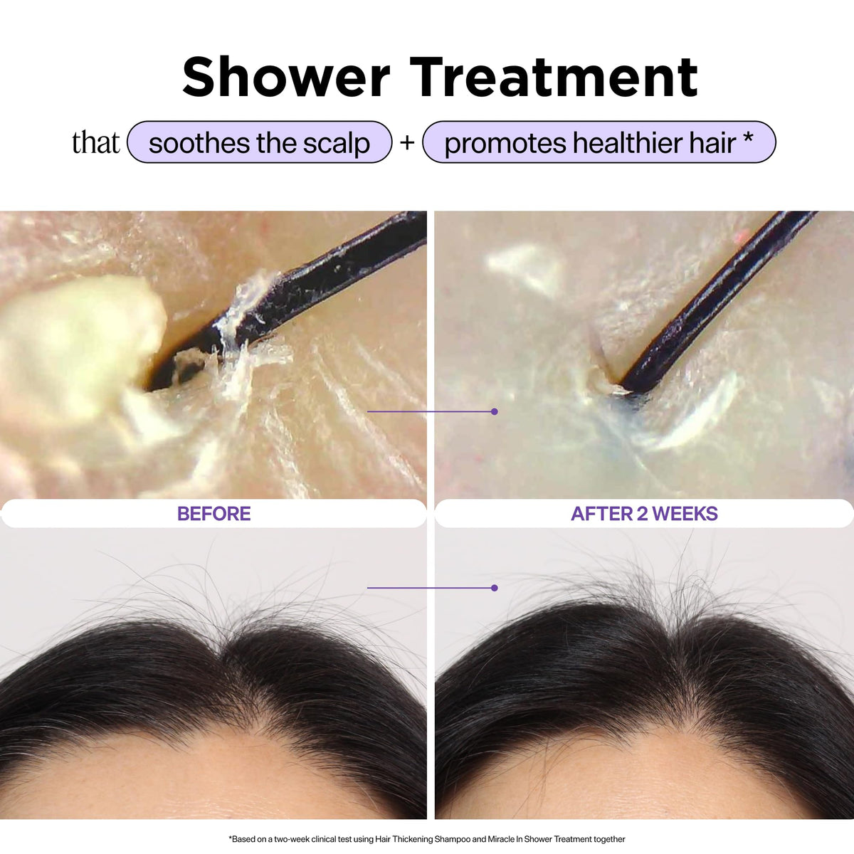Dr. Groot Miracle in Shower Treatment with Rosemary Oil
