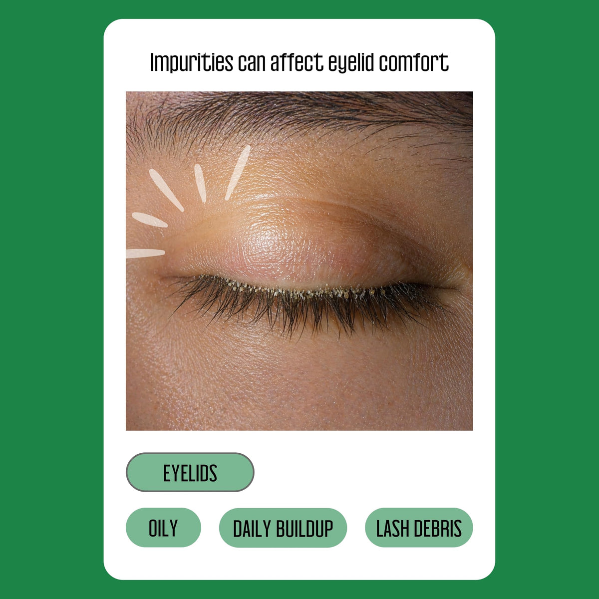 Tea Tree Eyelid Wipes, 100 Count, with Hyaluronic Acid
