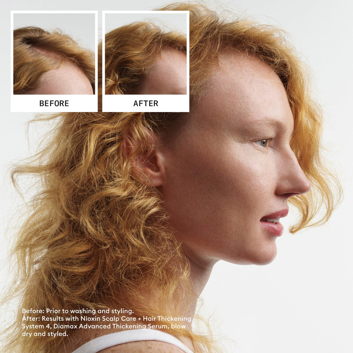 Nioxin Scalp + Hair Thickening System 4, Full Size